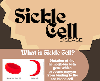Powepoint introduction page with the words "Sickle Cell Disease"